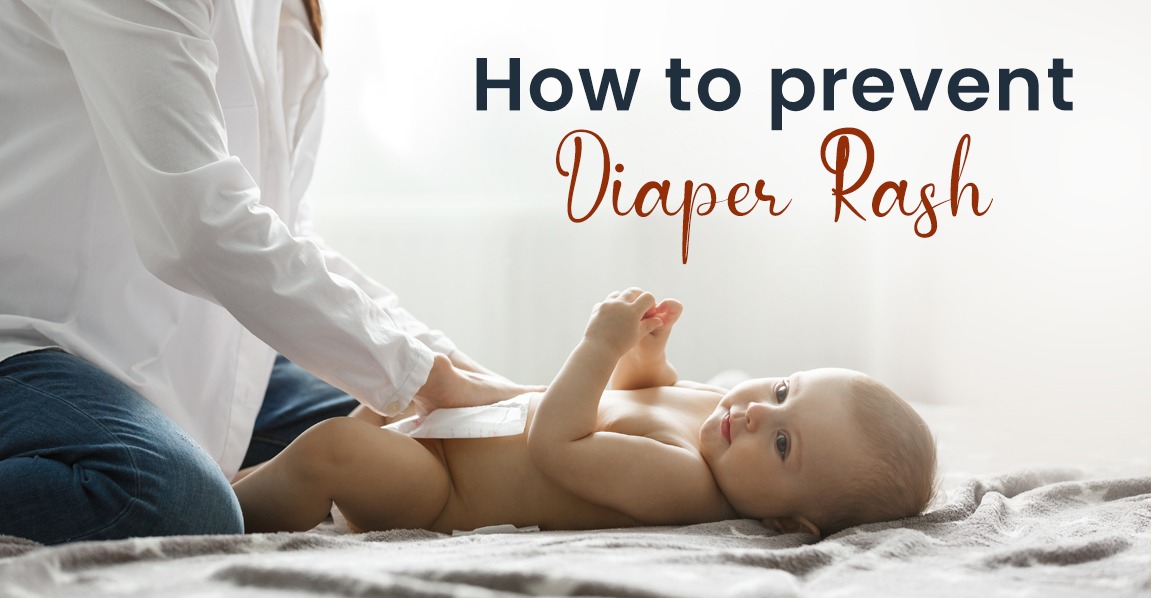 How to prevent diaper rash